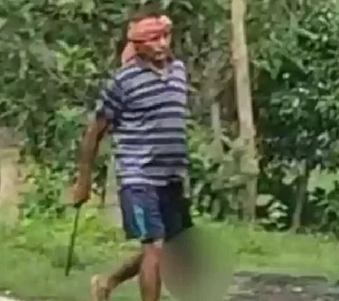 ಕೌಟುಂಬಿಕ ಕಲಹ: ಅತ್ತಿಗೆಯ ರುಂಡ ಕತ್ತರಿಸಿ ಪೊಲೀಸರಿಗೆ ಶರಣಾದ ವ್ಯಕ್ತಿ!