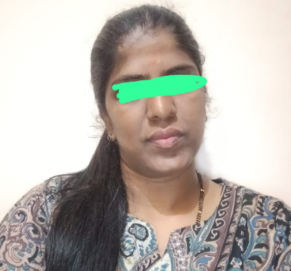 ಘೋರ ದುರಂತ: ಮಗಳನ್ನು ಮದುವೆ ಮಾಡಿ ಕೊಡಲಿಲ್ಲವೆಂದು ತಾಯಿಗೆ ಬೆಂಕಿ ಹಚ್ಚಿದ ಪಾಪಿ..!