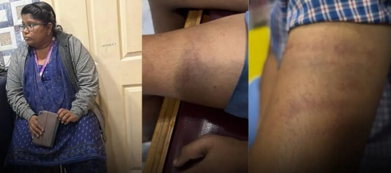 ಹೋಂವರ್ಕ್ ಮಾಡಿಲ್ಲವೆಂದು ಬಾಲಕನಿಗೆ ಶಿಕ್ಷಕಿಯಿಂದ ಕ್ರೂರ ಹಲ್ಲೆ: ಪೋಷಕರಿಗೆ ಹೇಳಿದ್ರೆ ಕುತ್ತಿಗೆ ಹಿಸುಕುತ್ತೇನೆ’ ಎಂದು ಬೆದರಿಕೆ