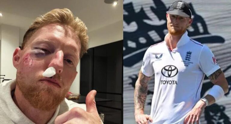 ಕ್ರಿಕೆಟ್ ಅಭ್ಯಾಸದ ವೇಳೆ ಮುಖಕ್ಕೆ ಬಡಿದ ಚಂಡು; ಬೆನ್ ಸ್ಟೋಕ್ಸ್​ಗೆ ಕಣ್ಣು, ಮುಖಕ್ಕೆ ಗಂಭೀರ ಗಾಯ!