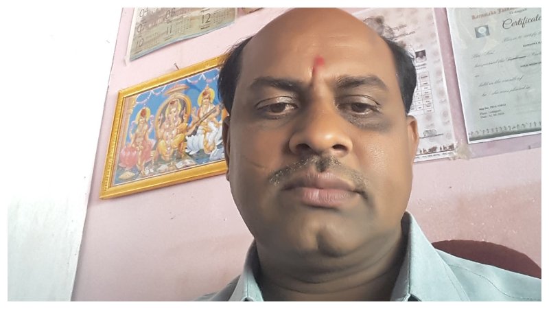 ಹಸೆಮಣೆ ಏರಬೇಕಿದ್ದ ಹಿಂದಿನ ದಿನವೇ ಸಾವು: ಪತ್ನಿ ಸಹೋದರಿಯ ಜೊತೆ ಮದುವೆಗೆ ಸಿದ್ಧವಾಗಿದ್ದ ಡಾ. ರಮೇಶ್ ಕೊಲೆ