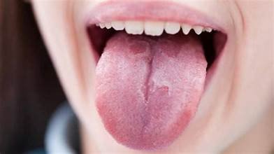 ನಾಲಿಗೆಯಲ್ಲಿ ಪದೇ-ಪದೇ ಹುಣ್ಣಾಗುತ್ತಾ!? ಹಾಗಿದ್ರೆ ಇದು ಗಂಭೀರ ರೋಗದ ಮುನ್ಸೂಚನೆ!