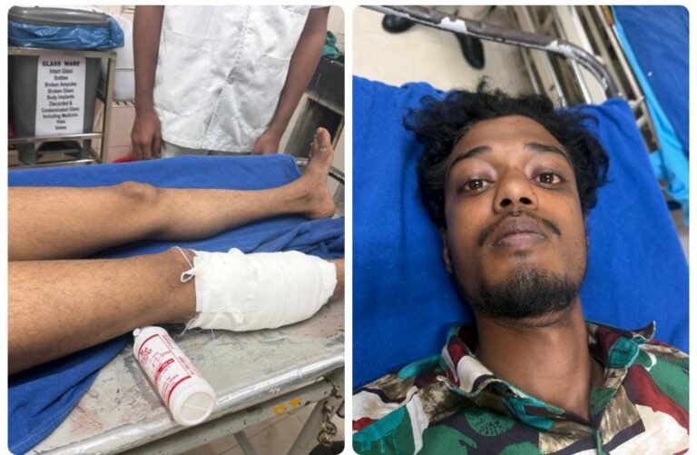 ಬಂಡೆಪಾಳ್ಯದಲ್ಲಿ ಮಧ್ಯರಾತ್ರಿ ಗುಂಡಿನ ಸದ್ದು: ಮಾರಕಾಸ್ತ್ರ ಹಿಡಿದು ಓಡಾಡುತ್ತಿದ್ದ ಆರೋಪಿಯ ಕಾಲಿಗೆ ಫೈರಿಂಗ್!