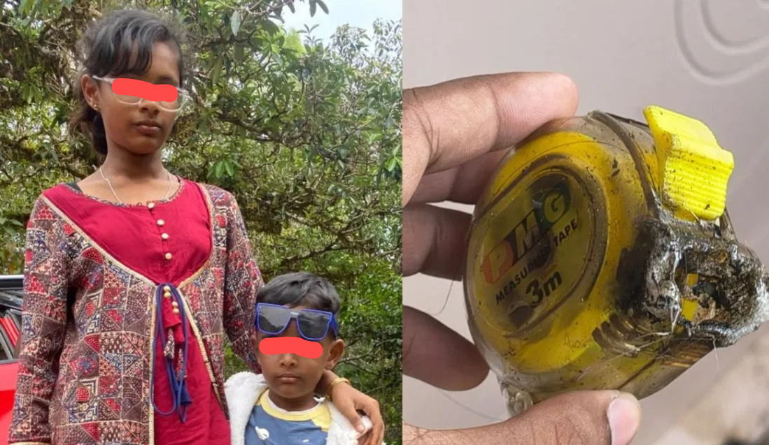 ರಾಜಾನುಕುಂಟೆಯಲ್ಲಿ ವಿದ್ಯುತ್ ಅವಘಡ: ಇಬ್ಬರು ಮಕ್ಕಳ ಸ್ಥಿತಿ ಗಂಭೀರ, ಬೆಸ್ಕಾಂ ಅಧಿಕಾರಿಗಳ ನಿರ್ಲಕ್ಷ್ಯ?